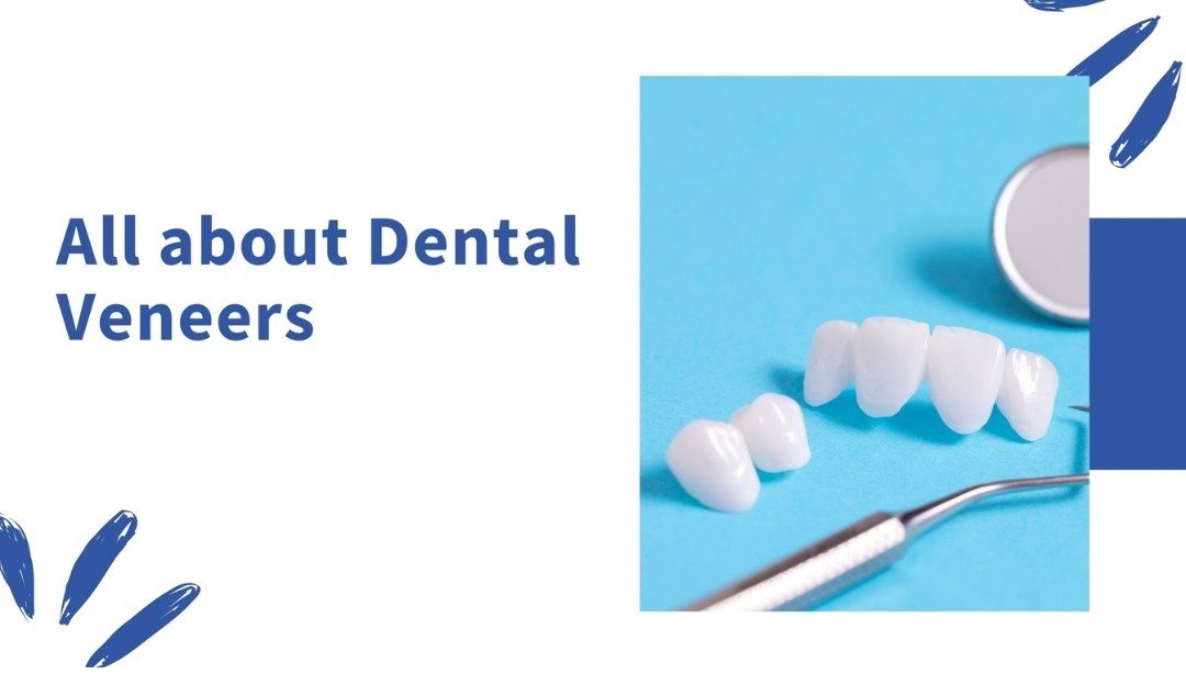 Close-up of dental veneers and dental tools on a blue background with the text "All about Dental Veneers."