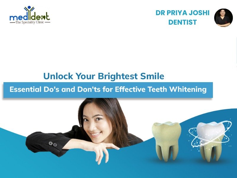 Read more about the article The Do’s and Don’ts of Teeth Whitening Aftercare