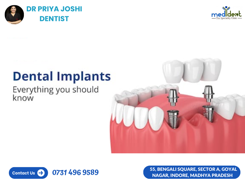 Read more about the article Transform Your Smile with Dr. Priya Joshi, the Best Dentist in Indore – Where Advanced Dental Implants Meet Exceptional Care!