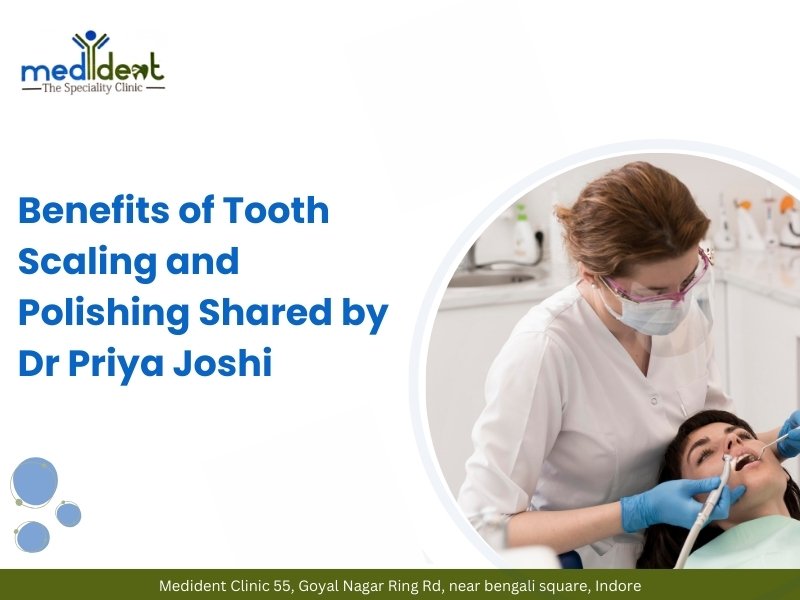 Benefits of Tooth Scaling and Polishing Shared by Dr Priya Joshi at Medident Clinic Indore